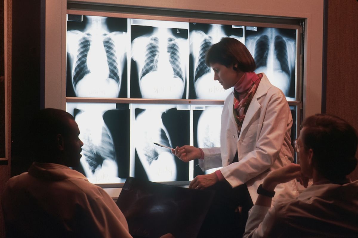 Leger gransker bildediagnostikk av lungene pa lysplate