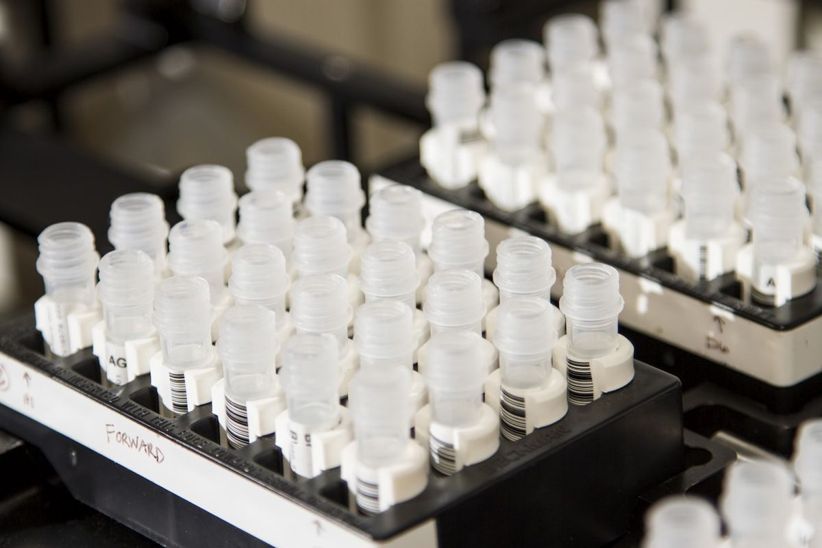 Reagensror med proever pa laboratorium